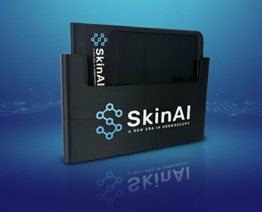 Dermatoscope mobile Skin AI avec IA de nouvelle génération
